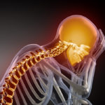 What Factors Can Affect A Personal Injury Settlement - Head Pain concept